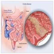 بررسی تاثیر آلودگی هوا بر دیابت نوع 2 و افزایش وزن تدوین شد.